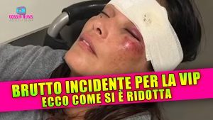 Brutto Incidente Per la Vip: Ecco Come Si è Ridotta!