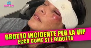 Brutto Incidente Per la Vip: Ecco Come Si è Ridotta!