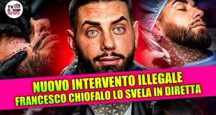 Francesco Chiofalo non smette di sorprendere e annuncia due nuovi interventi estetici