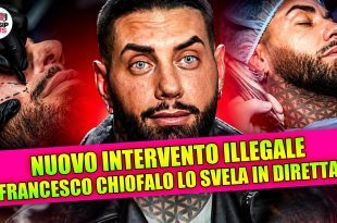 Francesco Chiofalo non smette di sorprendere e annuncia due nuovi interventi estetici